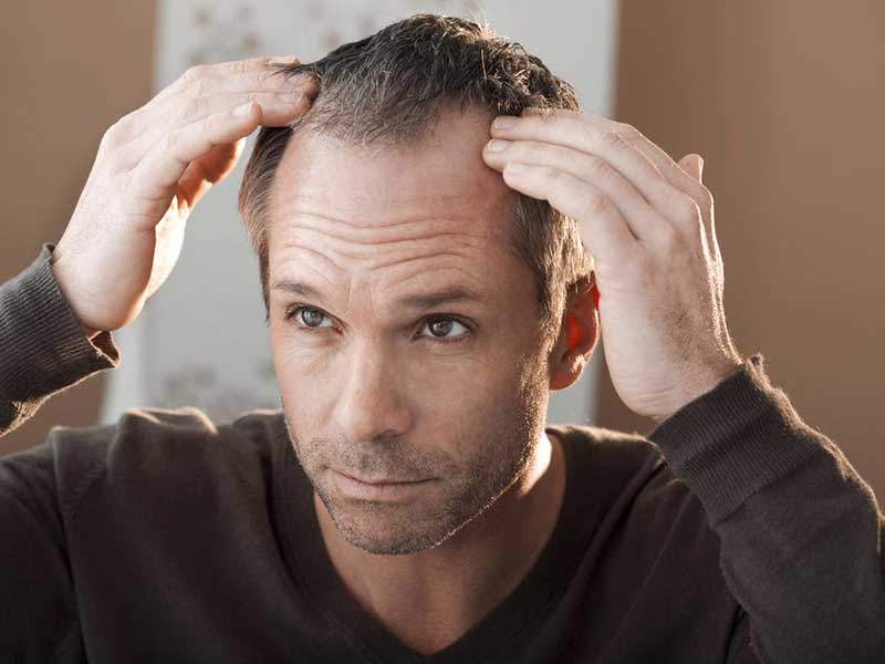 11 Hairstyles For Men With Thin Hair And Big Foreh 1 