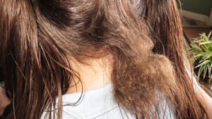 detangle matted hair