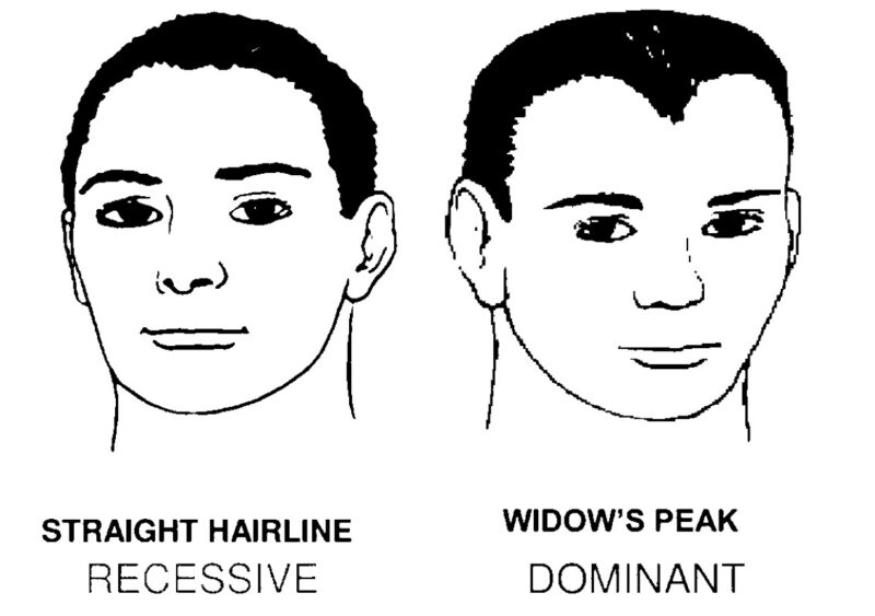 Do You Have Receding Hairline Or Widows Peak Hera Hair Beauty